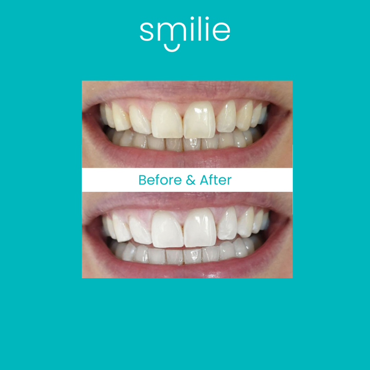 Smilie Super Glow Whitening Toothpaste