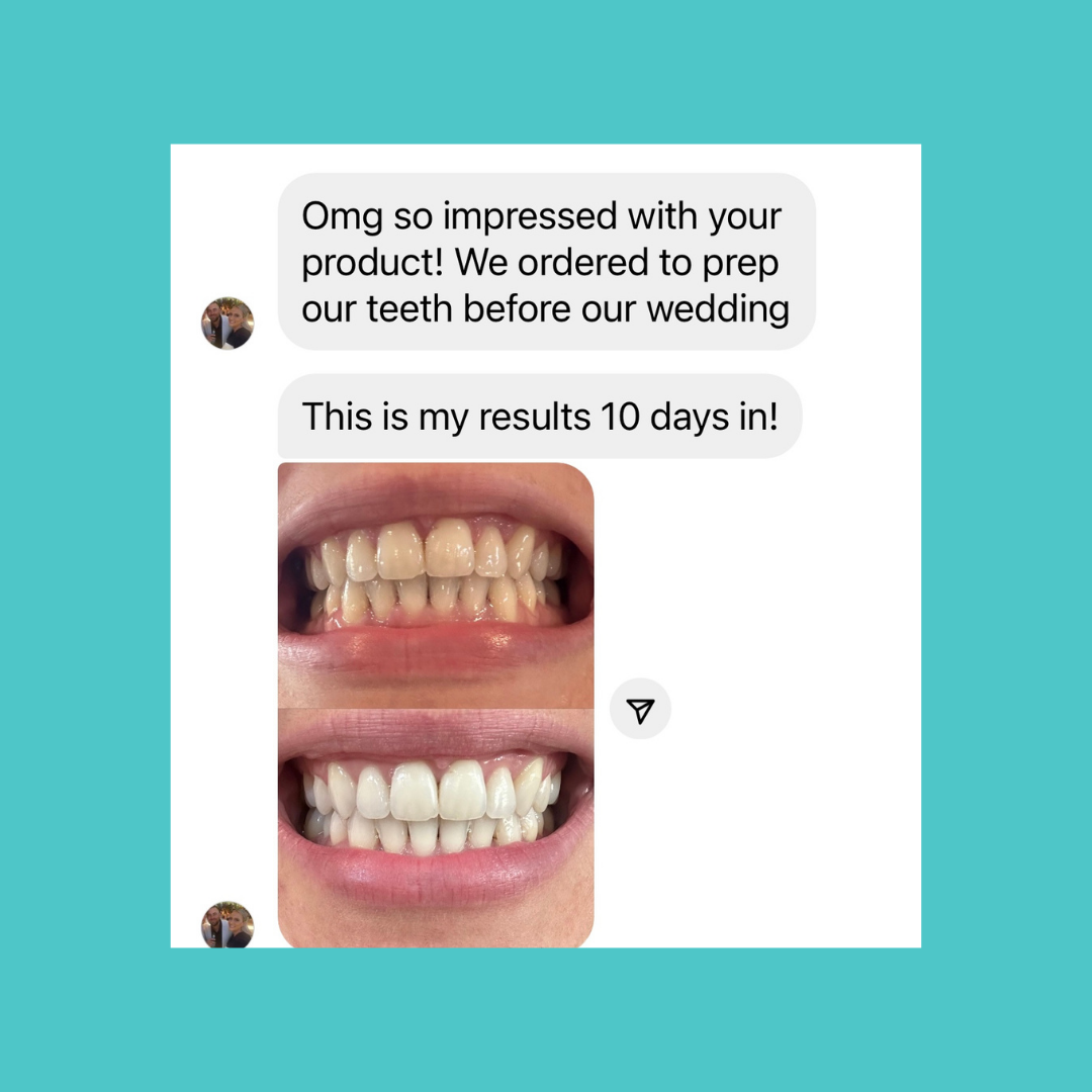 Smilie Ultra Bright Bundle