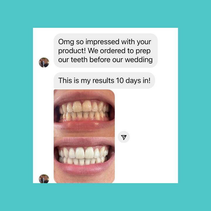 Smilie Ultra Bright Bundle