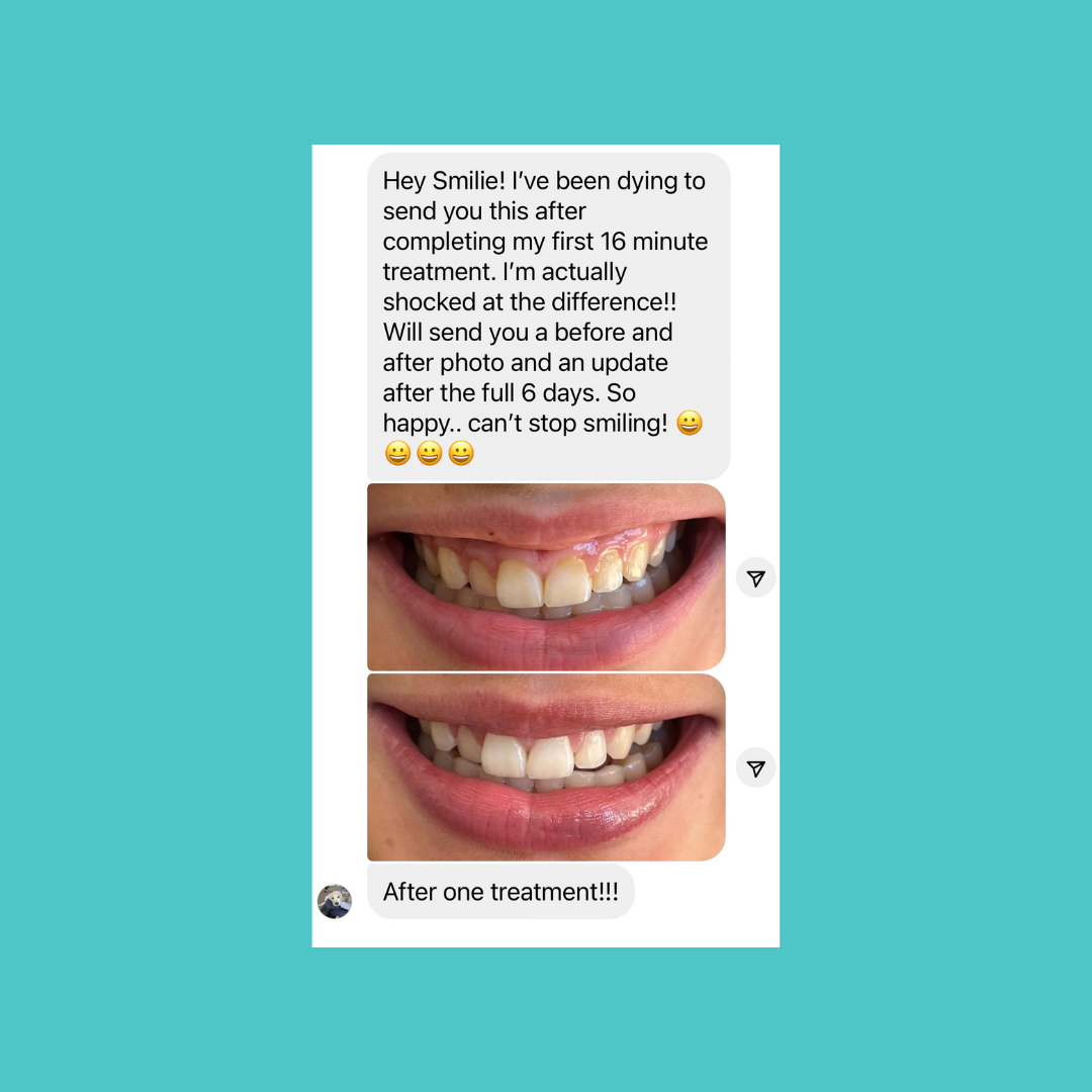 Smilie Boost Teeth Whitening Kit