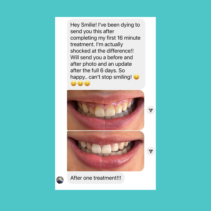 Smilie Boost Teeth Whitening Kit