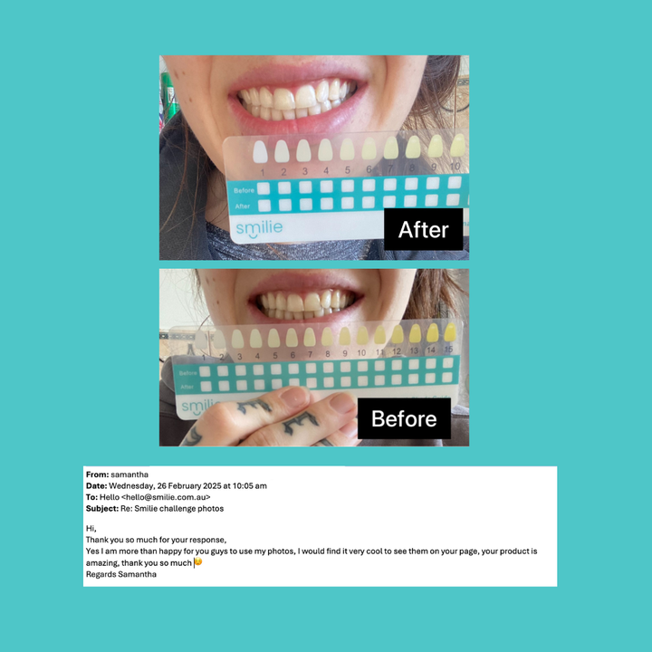 Smilie Boost Teeth Whitening Kit