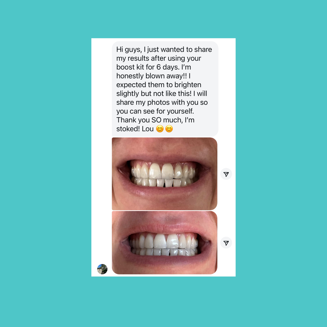 Smilie Boost Teeth Whitening Kit