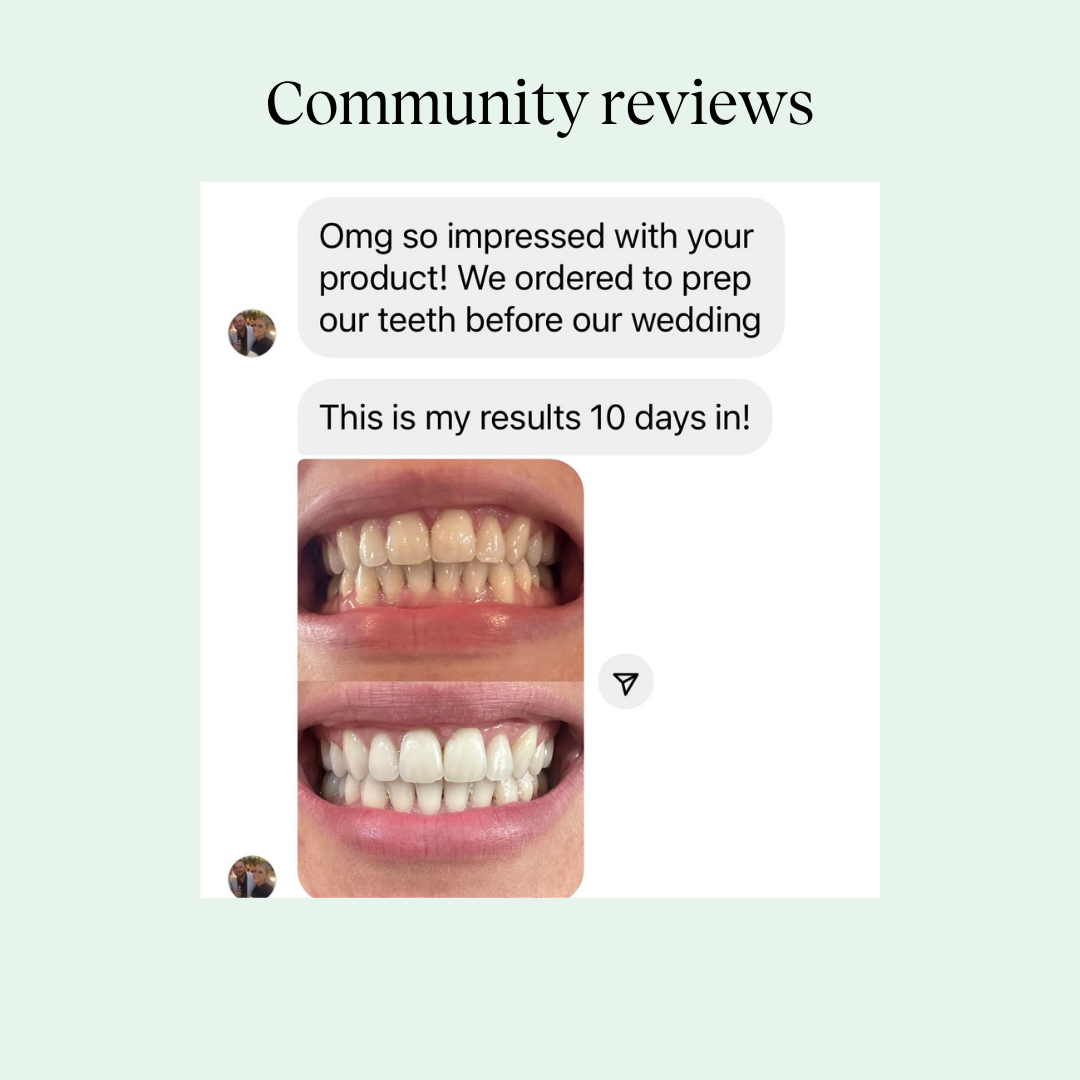 Complete Whitening System