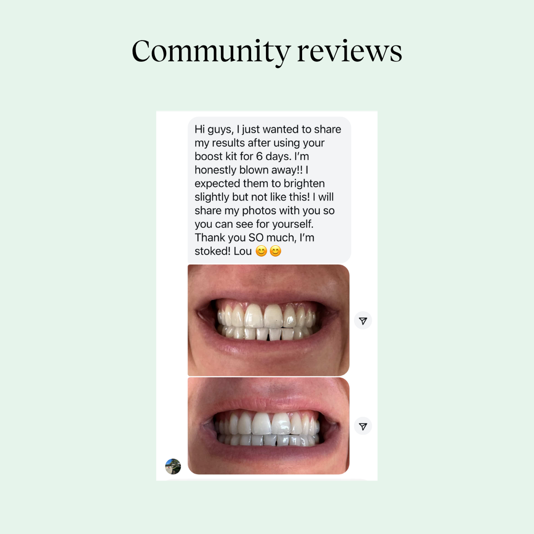 Whitening Gel Refills – 3 Pack