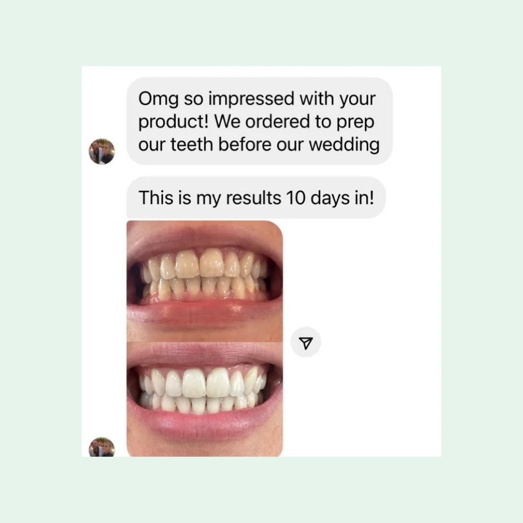 Boost Teeth Whitening Kit
