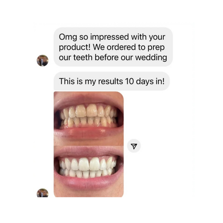 Smilie Starter Plus Bundle