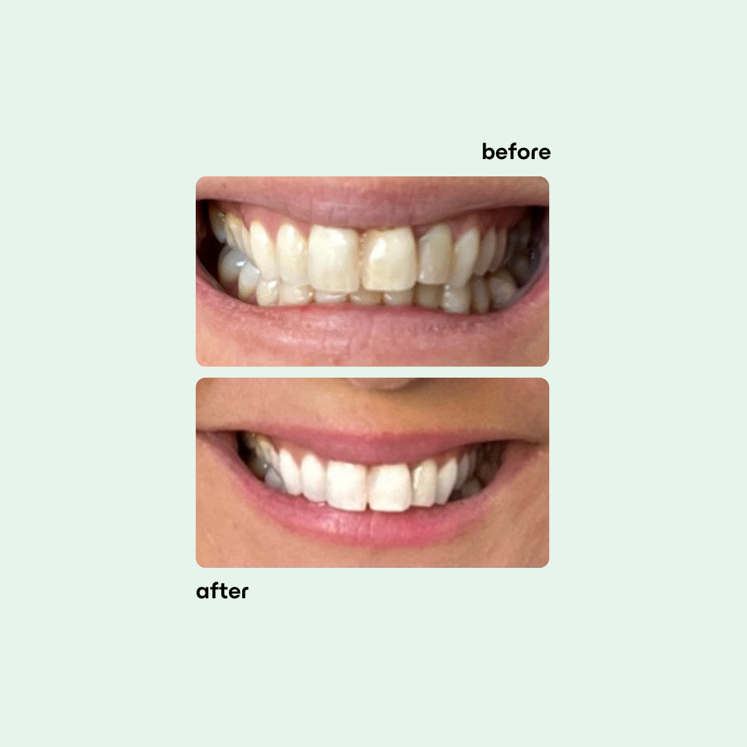 Super Glow Whitening Toothpaste